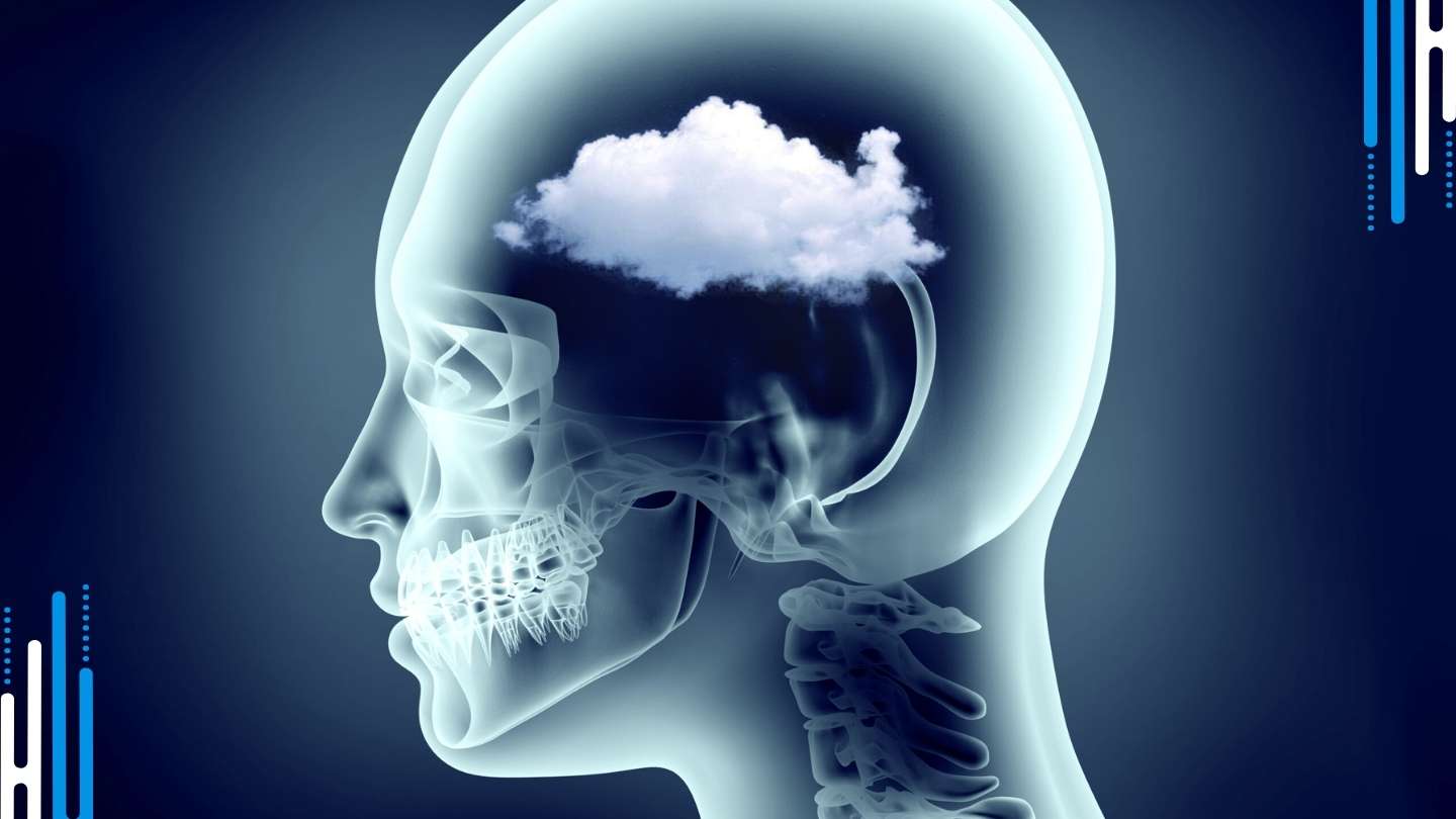 Brain Fog: The Cognitive Haze of Benzodiazepine Withdrawal