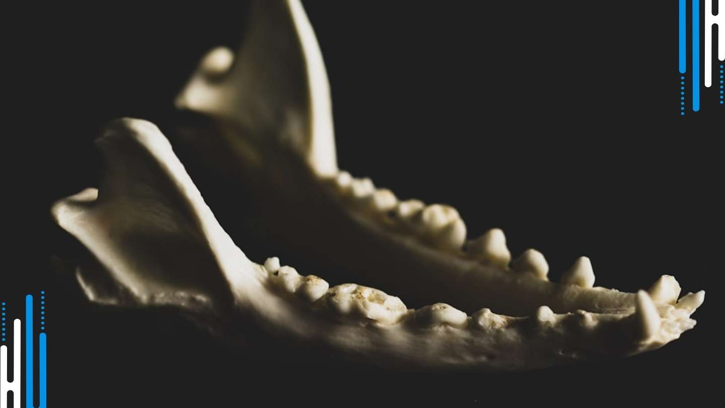 Teeth Grinding: The Jaw-Clenching Stress of Benzodiazepine Withdrawal