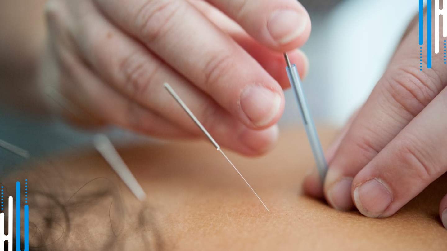 Managing Benzo Withdrawal: Tapering for Chest Pain Relief