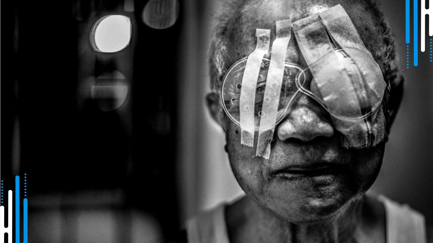 Tapering Benzodiazepines: Eyes on Withdrawal
